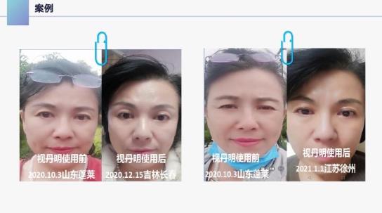 視丹明效果怎么樣,視丹明怎么代理的