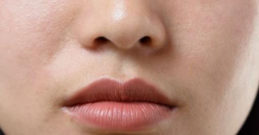 如何緩解紅血絲 臉上有紅血絲怎么回事