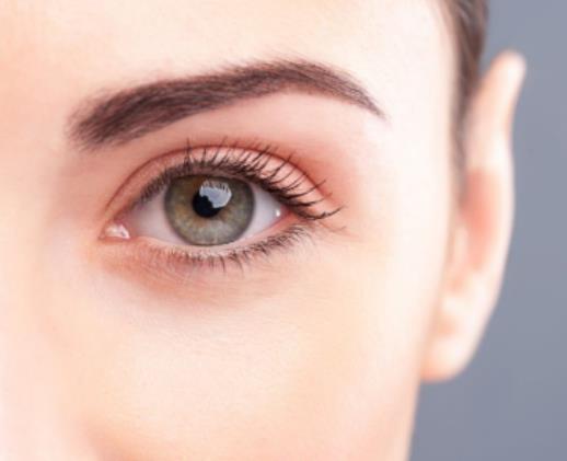 魚尾紋該如何去除 如何預防魚尾紋