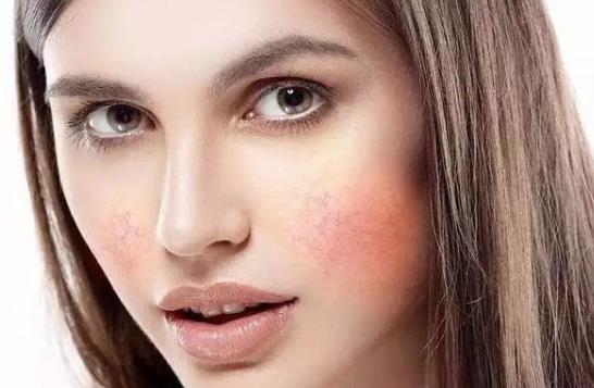 敏感肌膚有什么特征?敏感性皮膚能修復(fù)嗎?