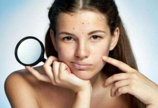 30歲了臉上還長痘痘是怎么回事?青春痘疫苗最新進展