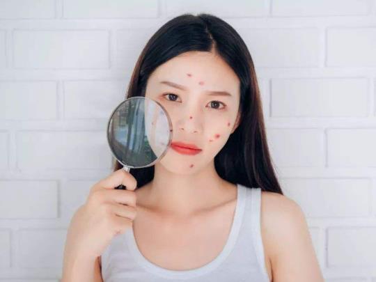 青春痘疫苗在臨床實踐中有什么作用?青春痘疫苗可以打嗎