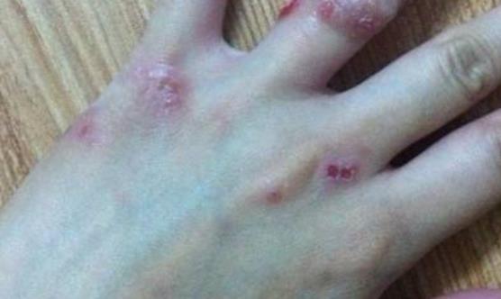 壓力過大會導致皮膚病的發生 這10大減壓法要收好