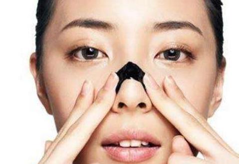 黑頭最常見的就是在鼻翼兩側了 去黑頭方法有3個