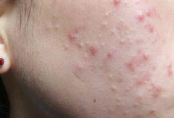 簡單的補血美顏法 睡眠對養(yǎng)膚有影響