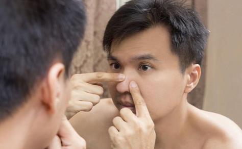 祛痘的日常護理和最佳時間 中醫祛痘有沒有效果