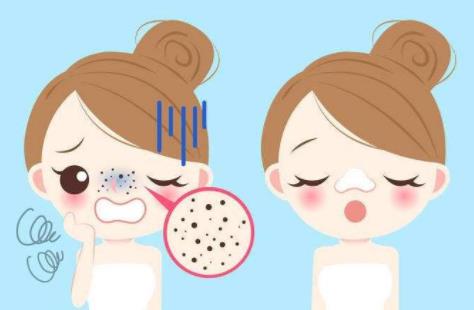 黑頭去了又長怎么辦 史上最全最有效的去黑頭指南