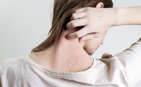 敏感體質的自我檢測方法 過敏性患者該怎么忌口