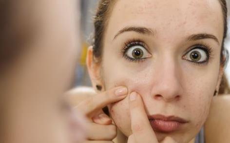 安全健康還你光滑皮膚的祛痘方法 怎樣避免祛痘后留疤