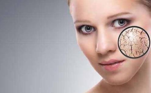 皮膚為什么會干燥脫皮 皮膚干燥脫皮了該怎么辦