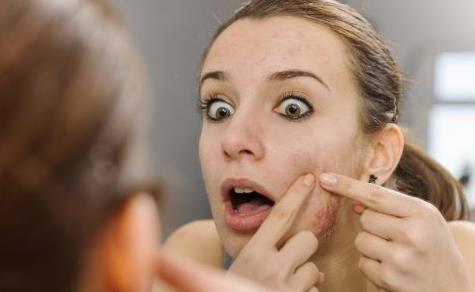 臉上反復(fù)長(zhǎng)痘痘的原因及解決方法 洗臉去痘小訣竅