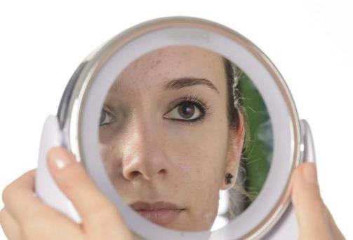 臉上反復(fù)長(zhǎng)痘痘的原因及解決方法 洗臉去痘小訣竅