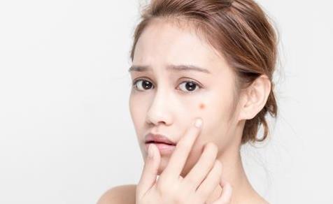 臉上反復(fù)長(zhǎng)痘痘的原因及解決方法 洗臉去痘小訣竅