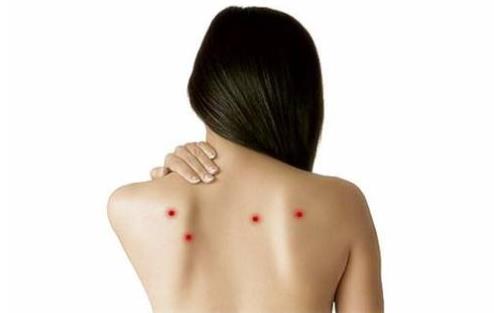 背部為什么會長痘 背部長痘的話應該要怎么處理