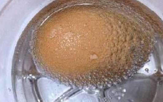 醋泡雞蛋祛斑 醋泡雞蛋祛斑的美容功效