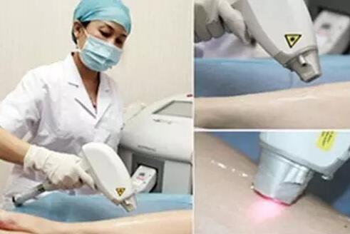 較真:雞皮膚可以根治嗎?去掉雞皮膚要多少錢