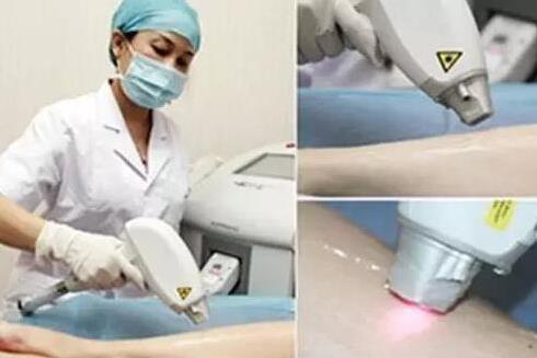 去雞皮膚用什么藥膏最好 親歷體驗更有發言權