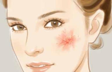 臉上有紅血絲怎么辦,換季敏感肌紅血絲加重的修復(fù)辦法