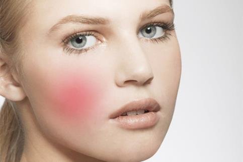 臉上紅血絲如何去除,換季臉紅發(fā)燙紅血絲嚴(yán)重怎么辦