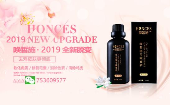 腿上雞皮膚怎么消除 這個夏天腿能變白嗎