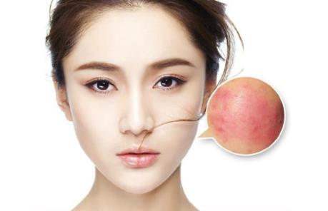 臉上紅血絲如何去除,去紅血絲最簡單的方法