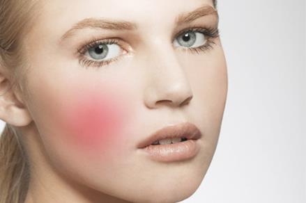 臉上有紅血絲能治嗎 臉上有紅血絲怎么辦