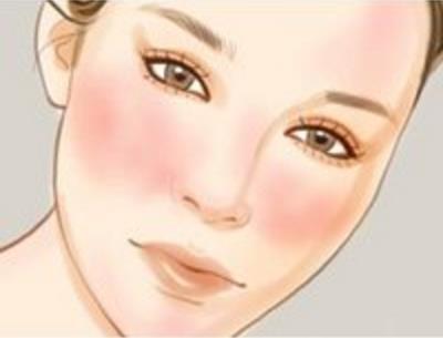 臉上有紅血絲能治嗎 臉上有紅血絲怎么辦