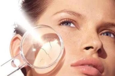 面部紅血絲怎么去除,有了紅血絲怎么辦