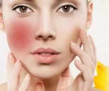 臉上紅血絲如何治療,臉上長(zhǎng)紅血絲怎么治