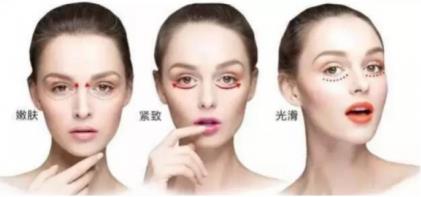 香蜜麗格黎京雄院長Fotona 4D魅眼光雕祛除黑眼圈