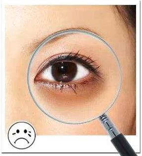 香蜜麗格黎京雄院長Fotona 4D魅眼光雕祛除黑眼圈