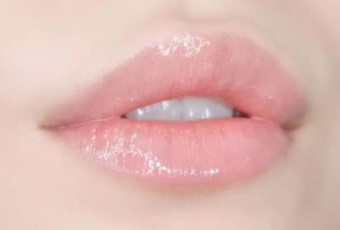 什么是豐唇術 豐唇術能維持多久 豐唇術注意事項