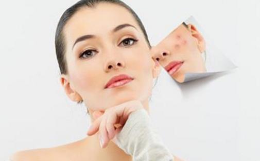 光子去魚尾紋要注意什么?光子嫩膚法祛痘印效果好嗎