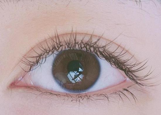 不動刀的雙眼皮叫什么?埋線雙眼皮還會變單嗎?