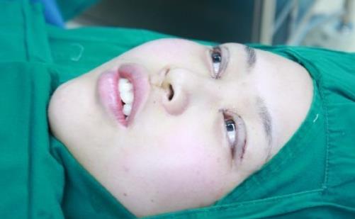 關于重瞼術的常見疑問解答 重瞼術術后護理該怎么做