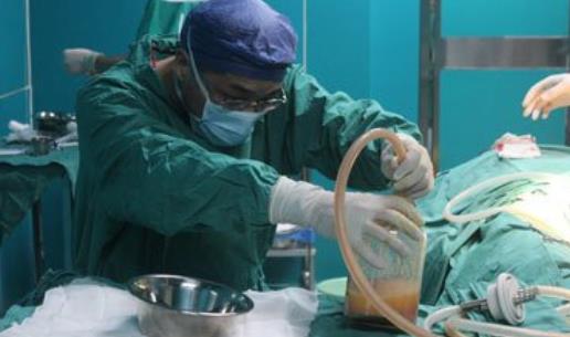 什么是抽脂手術怎么進行 抽脂手術會帶來什么樣的危害