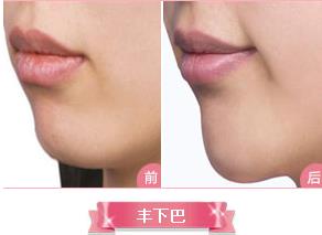 宿州陽光整形醫院怎樣 給你最美的顏值