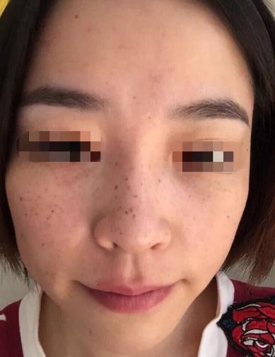 廈門薇格整形醫院皮秒激光如何 幫你解決各種肌膚問題