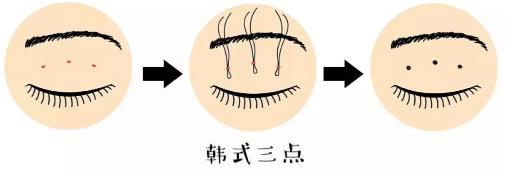 鄭州美萊整形靠譜么 重塑優(yōu)美弧線靈韻精雕大眼