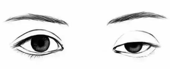 昆明藝星整形做雙眼皮好嗎 美麗獨(dú)秀高貴皇后