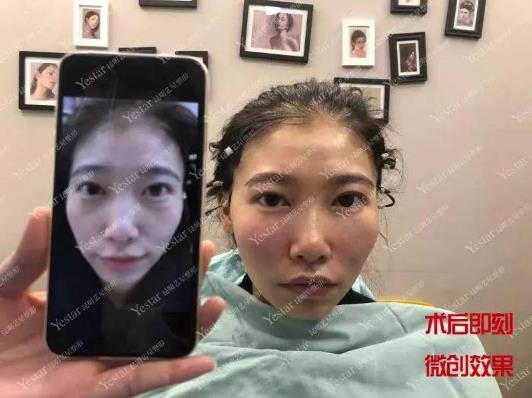 昆明藝星整形醫院可靠么 素顏女神