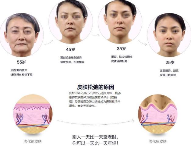 昆明藝星整形醫院可靠么 素顏女神