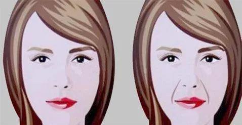 北京伊美爾醫(yī)療醫(yī)院:鼻唇溝是哪里