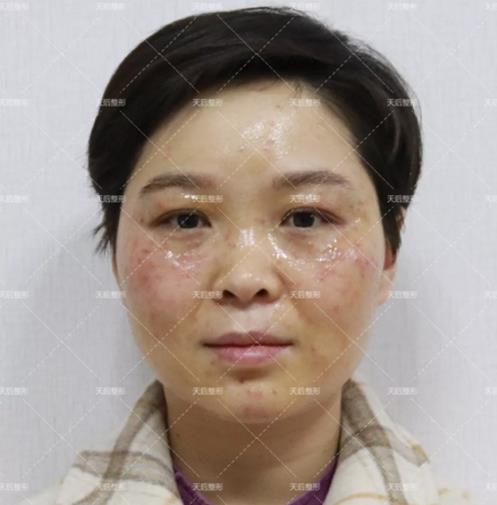 鄭州天后醫療美容醫院好嗎 點燃您的靚麗豐采