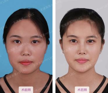 天津美萊醫院正規嗎 熱心服務 真心對待 衷心祝福