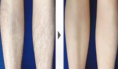 天津美萊醫院正規嗎 熱心服務 真心對待 衷心祝福