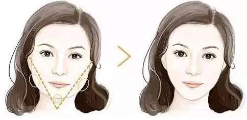 鄭州美萊整形醫院的評價 瘦臉針輕松瘦臉