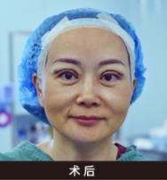 深圳美萊眼整形“雙杰”亮相2019中國眼整形高峰論壇