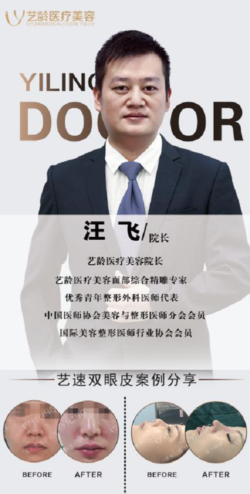 貴陽藝齡汪飛院長揭秘為什么鼻整形顯假 打造精致自然鼻