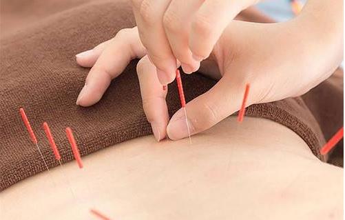 針灸減肥 針灸為什么能減掉脂肪?針灸減脂的原理